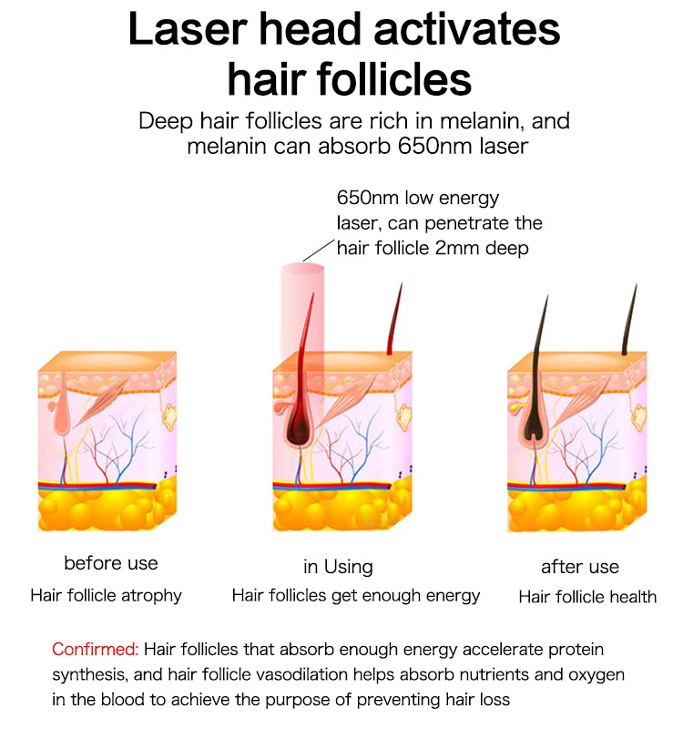 Anti Hair Loss Helmet Laser Regrowth Massager Cap 650nm Laser Wavelength Hair Growth Treatment Hat