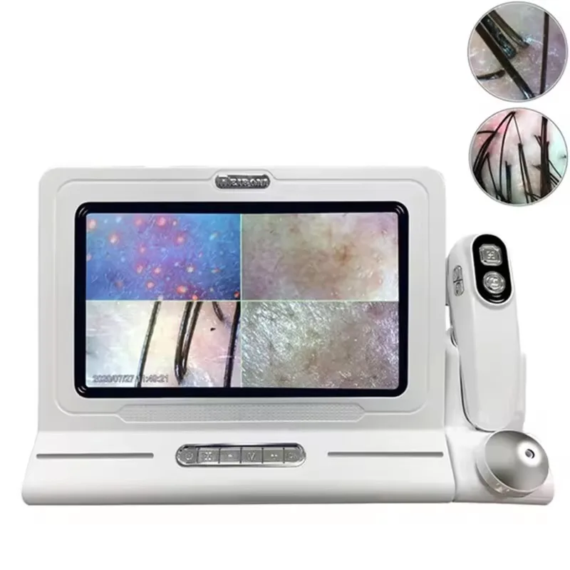 Professional Manufacturer hair Analysis Machine Hair And Scalp Analysis Hair Testing Machine with cheap price