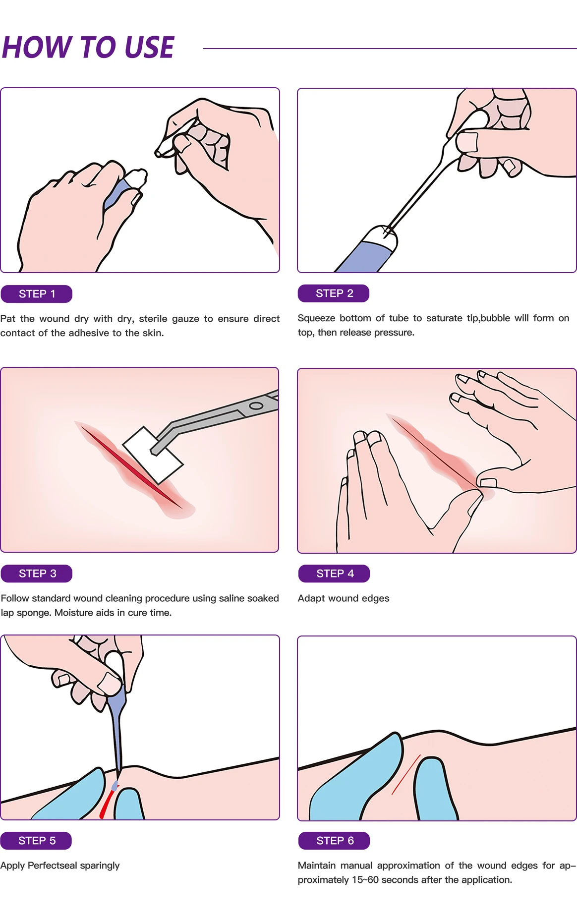 Best skin glue surgical tissue adhesive for wound closure