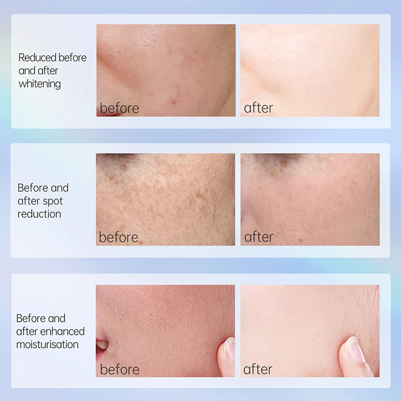 Custom logo ultra glowing skin whitening facial cream private label organic Dark Spot Remover Moisturizing face cream