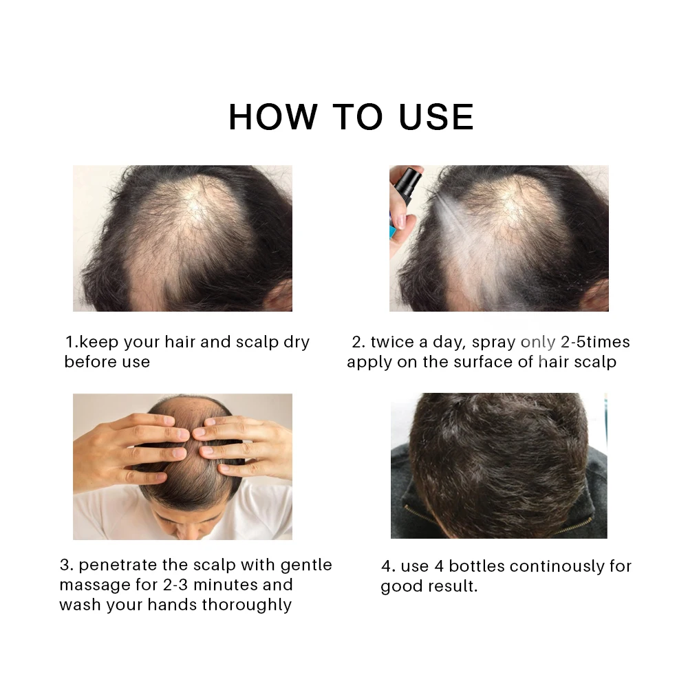 system jamaican black castor oil faster hair growth products  shampoo cream