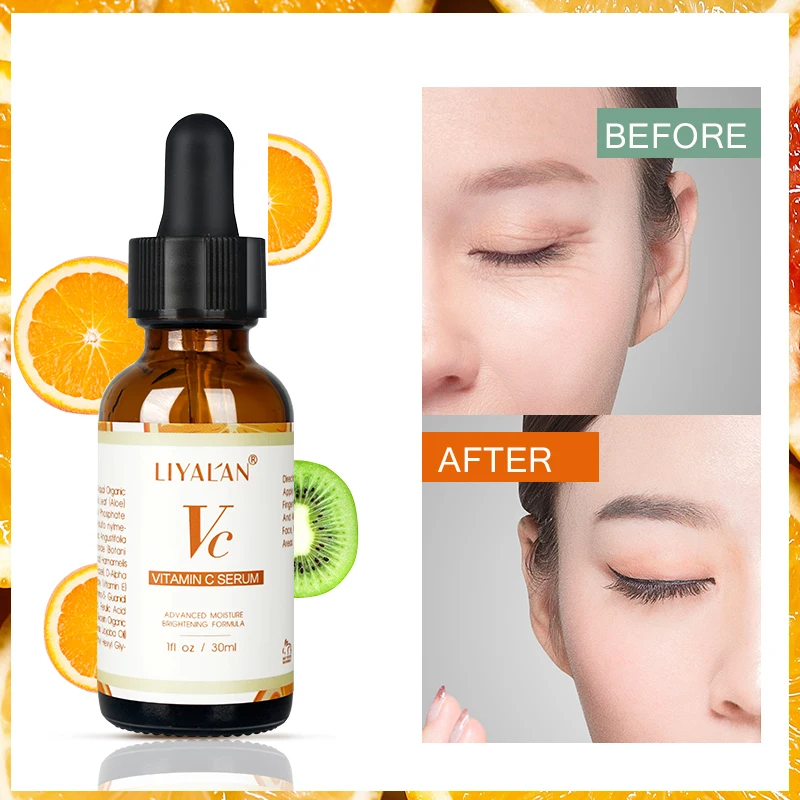 Skin Care Age Serum Moisturizing Whitening Vitamin C Retinol Hyaluronic Acid Face Serum