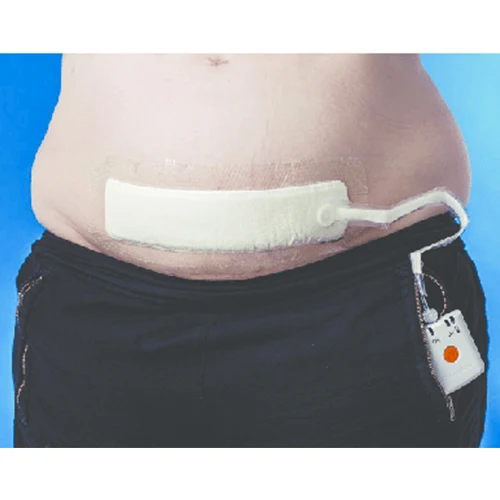 Factory Price Customized Size Lightweight Negative pressure wound therapy system dressing kit set NPWT Unit