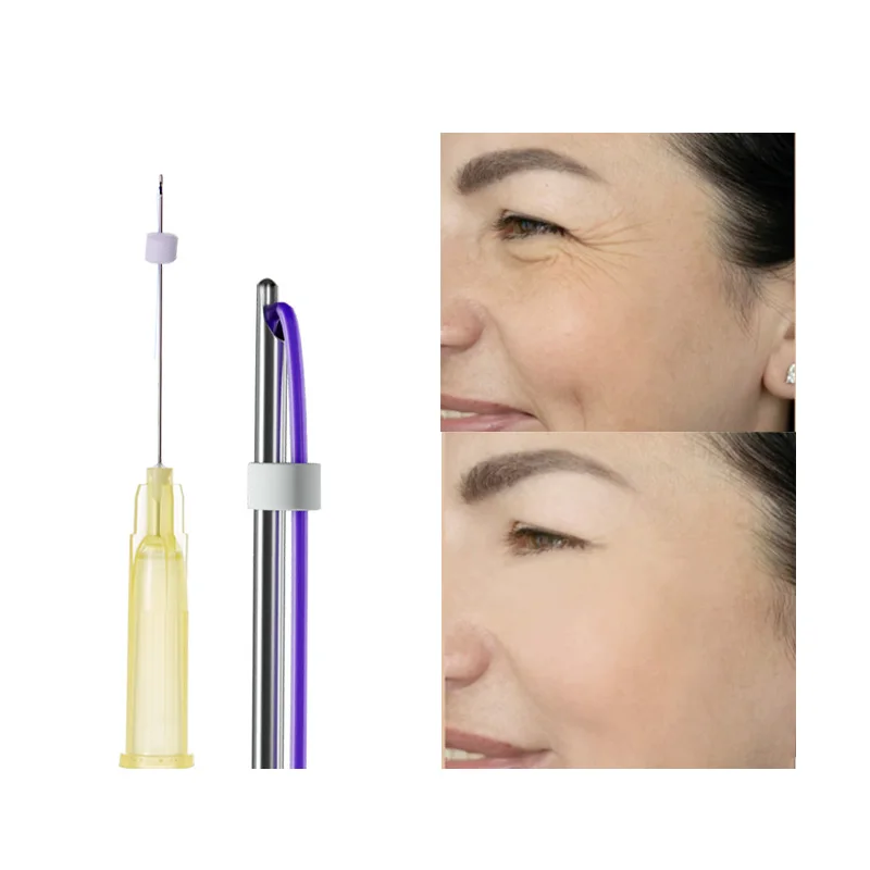 wholesale eye wrinkles lifting 30g blunt needle mono pdo thread