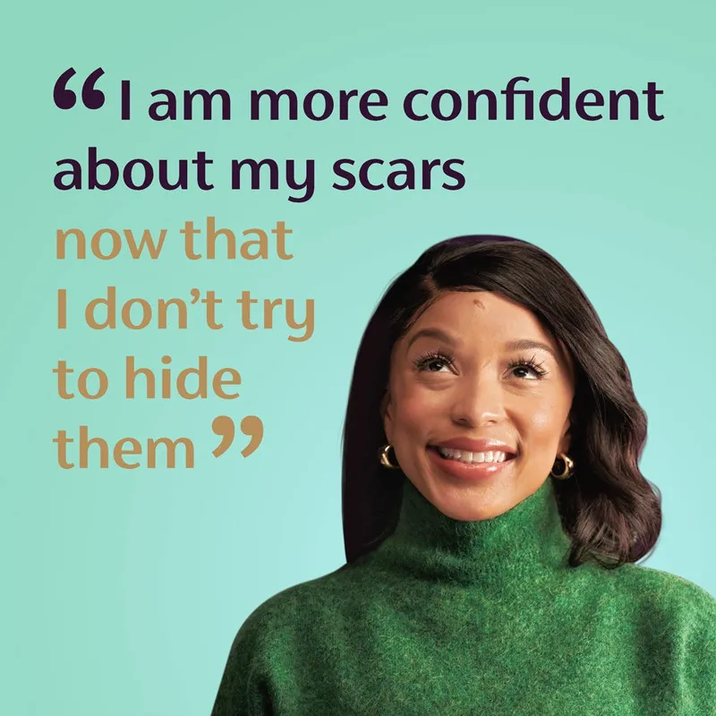 Jiajie OEM Customization Treatment for Old and New Scars Advanced Scar Gel