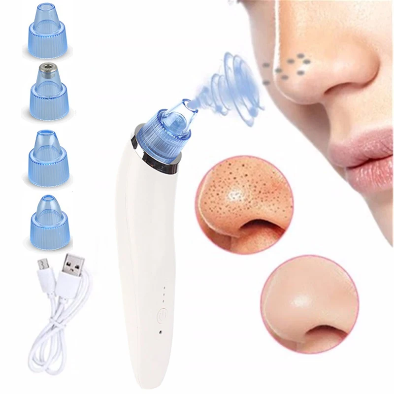 Blackhead Remover Pore Vacuum - Electric Face Vacuum Pore Cleaner Acne White Heads Removal with 4 Suction Head