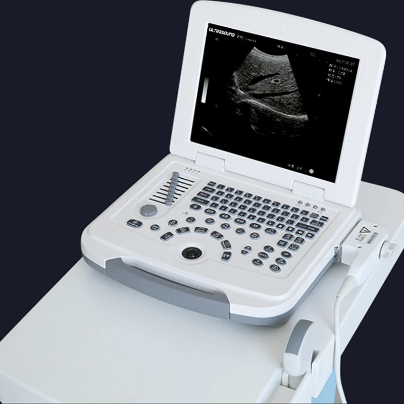 SoyMed doppler ultrasonic phased array flaw detector medical cardiac ultrasound instruments