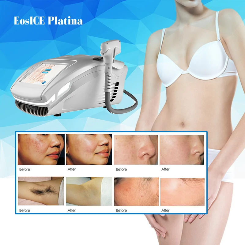 2022 hair removal equipment laser 755nm light sheer diode laser machine for three in one laser hair removal