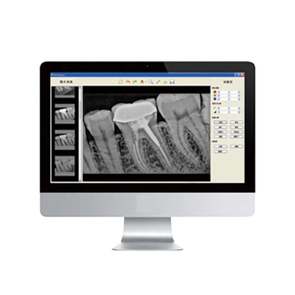 65kV 2mA High Frequency Dental Portable X-ray Machine Unit with Digital RVG Sensor