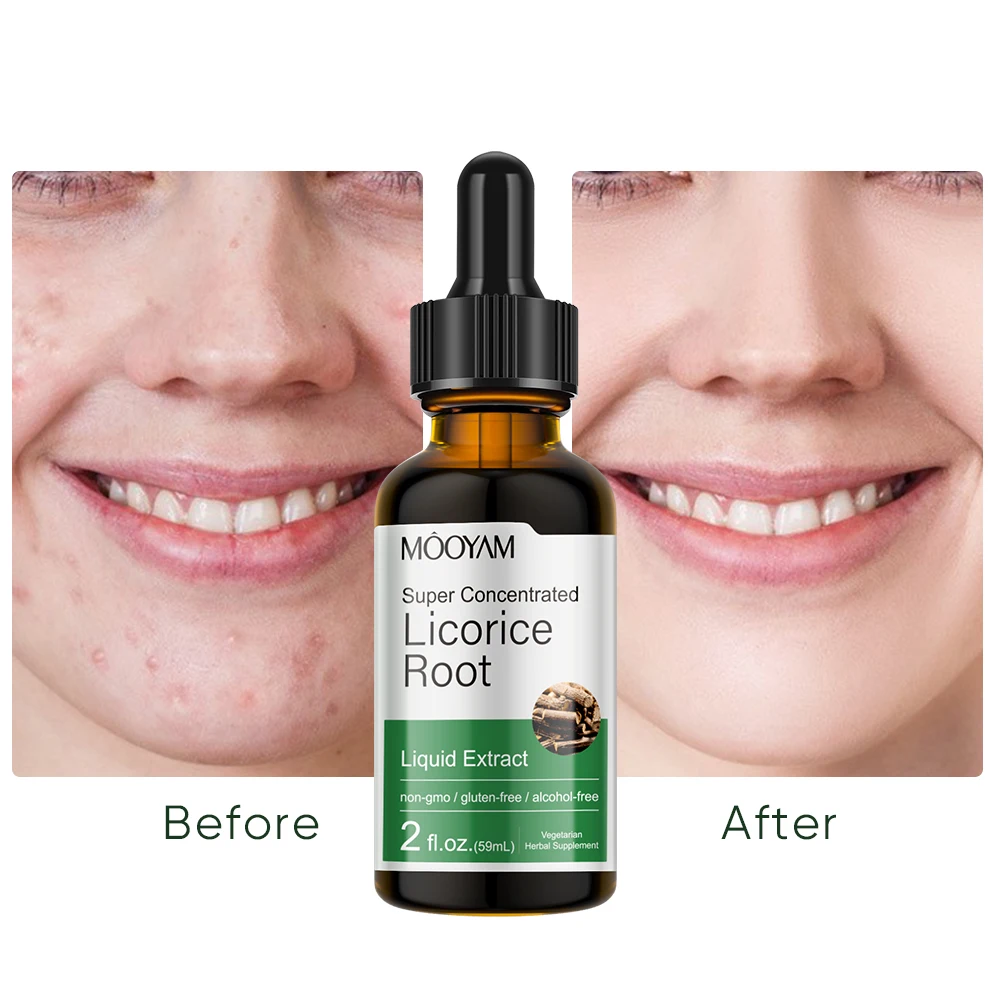 Brightens Skin From The Inside Out Deeply Hydrates Whitening Firming Lightening Pigmentation Corrector 59ml MOOYAM Licorice Root