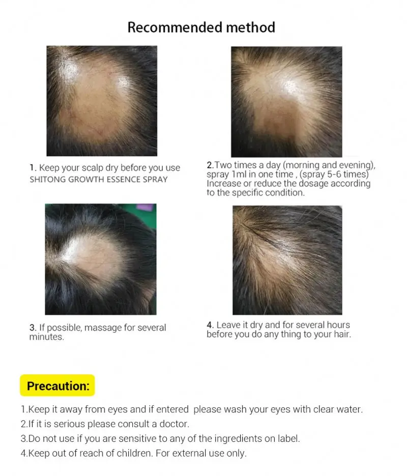 Buy stuff in bulk to resell hairgrowth rice water hair growth spray