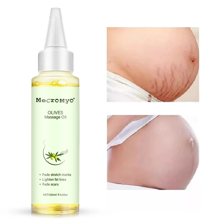 Private Label Olive oil Vegan Maternity Skin Care Body Scar Stretch Mark Removal Oil Stretch Mark Oil