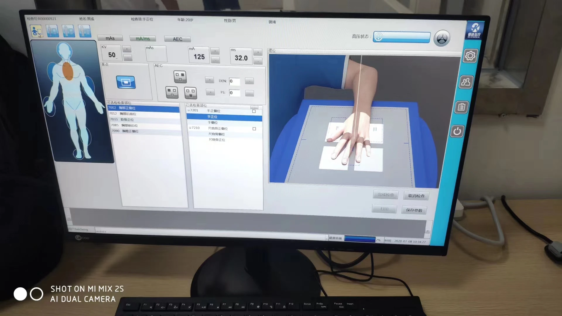 Классическая медицинская рентгеновская цифровая машина, электрическая сталь, Ce Медицинское рентгеновское оборудование и аксессуары, онлайн техническая поддержка, класс II