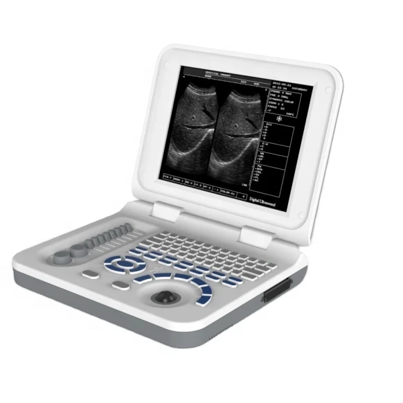 Ultrasound Scanner Diagnostic System portable notebook 12 1inch machine ecograph S50A LED medical Ultrasound Scanner doppler