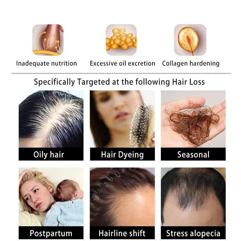 7 Days Ginger Hair Grower Hydrating Shampoo Anti Dandruff Herbal Against Hair Fall Private Label Hair Growth Shampoo