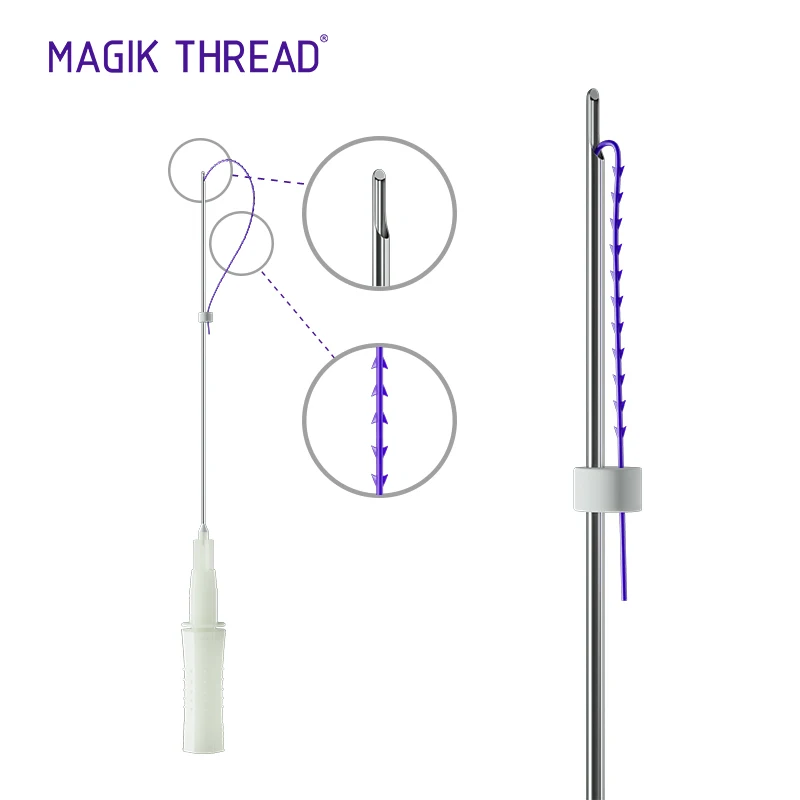 Magik Thread best selling molding cog 18g 100 fishbone whale pdo face lifting cannula pcl threads for the neck