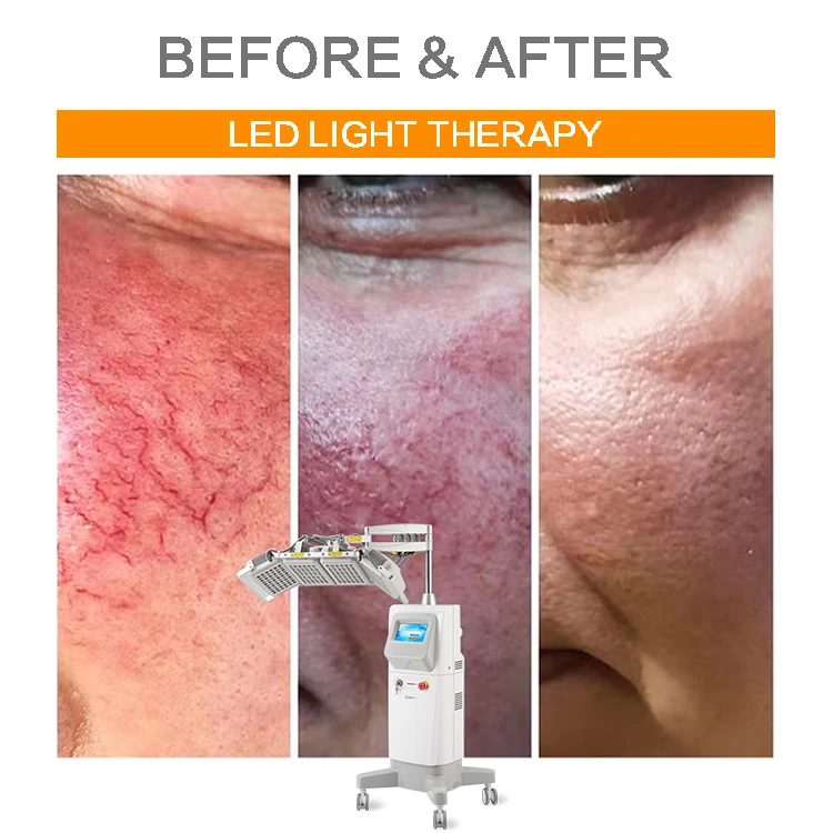 Red Near Infrared Light Therapy Bed Red Light device panel pdt led light therapy machine