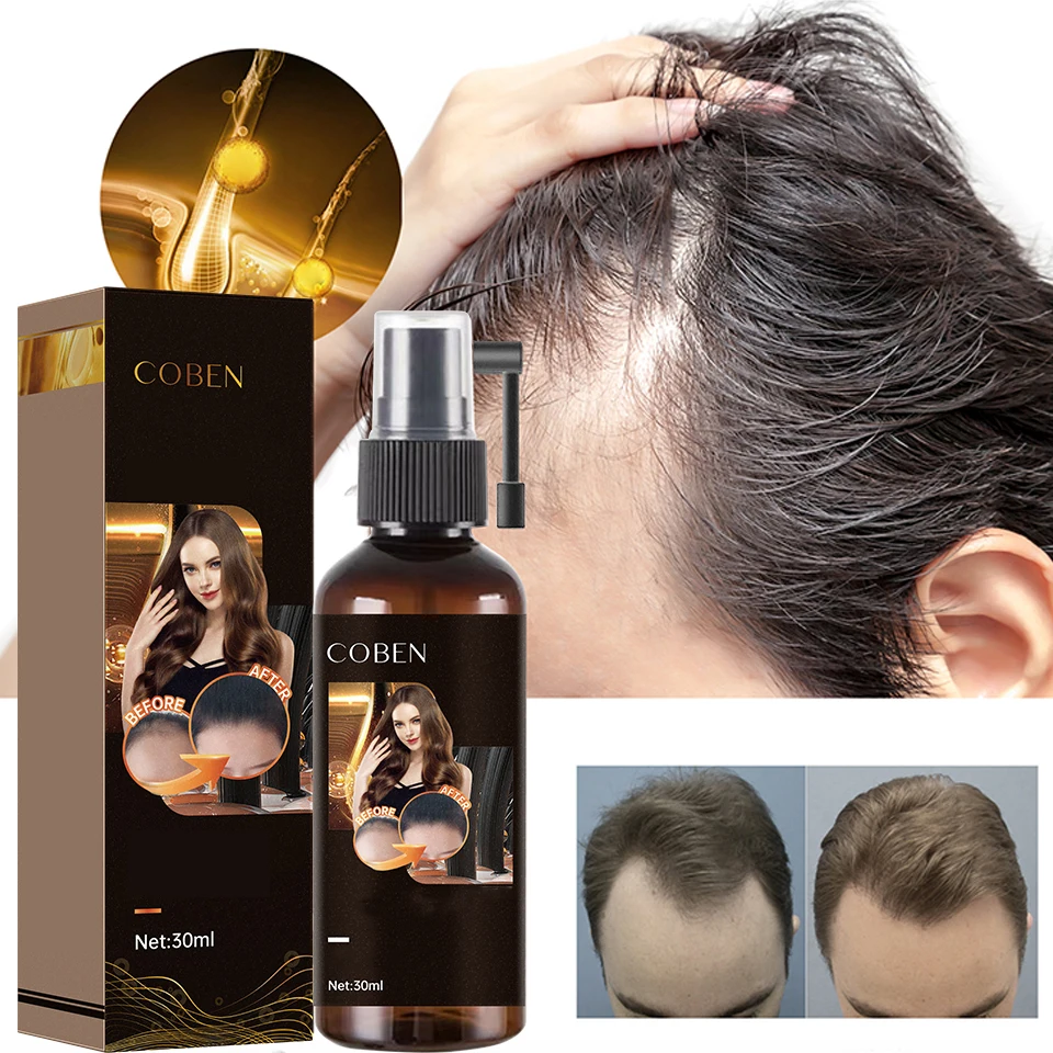Wholesale Organic Fast Hair Growth Oil Best Hair Regrowth Spray Anti Loss Natural Hair Growth Serum Oil