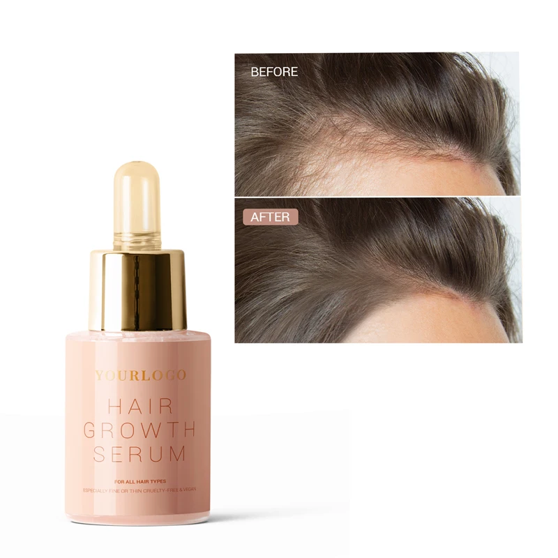 OEM High Quality Promotes Protein Binding Pure Coconut Milk Hair Care Product Hair Growth Serum