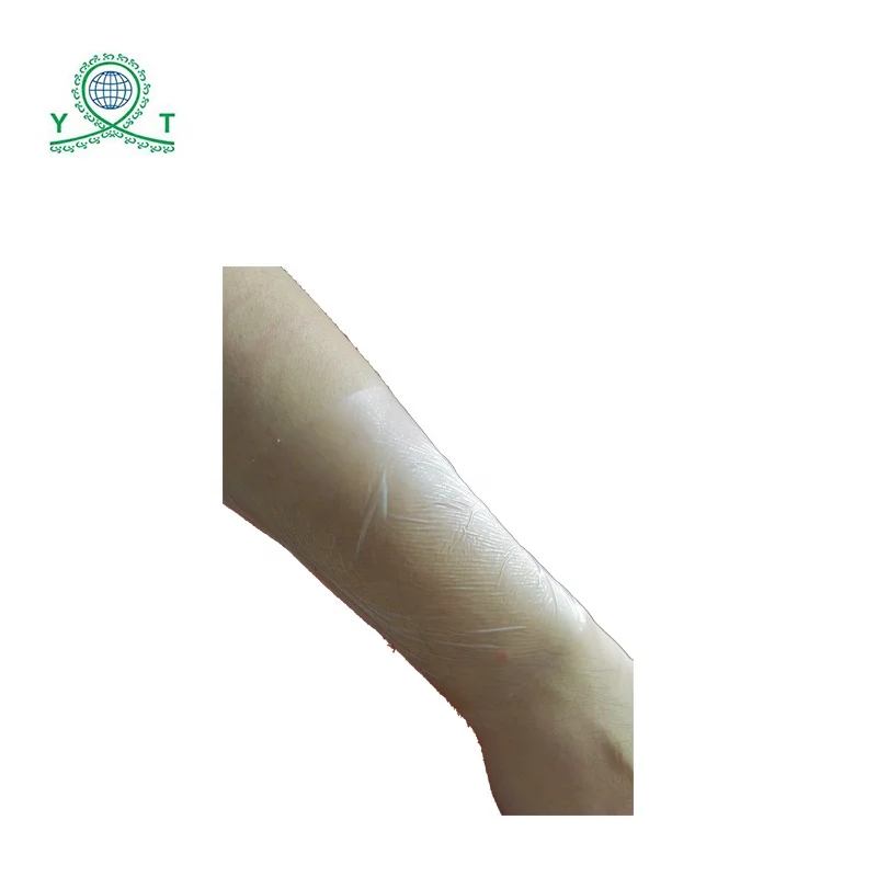 Yitong Medical Adhesive Incise Drape Film/ Surgical PE Waterproof Transparent Blow Molding 5cm/7.5cm/10cm/15cm or Custom CN;GUA