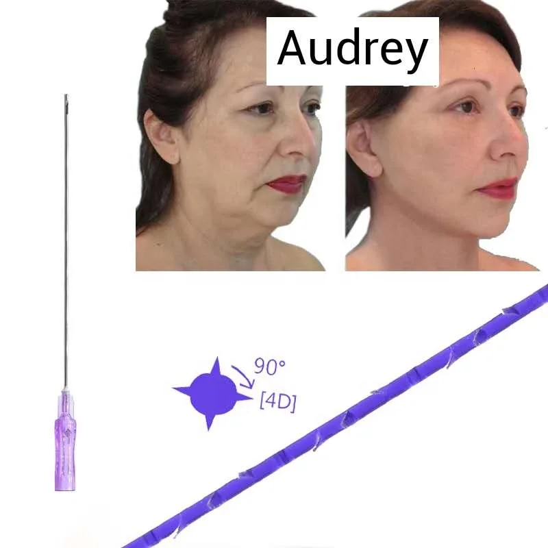 
Korea hot sale Face thread lift face pdo Koreadouble needle pdo threads cog nose eye lips tread lifting 