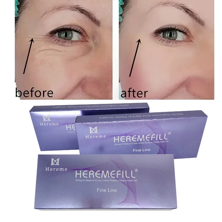 Heremefill  Injecting cross-linked gel hyaluronic acid skin filling facial filler facial wrinkles