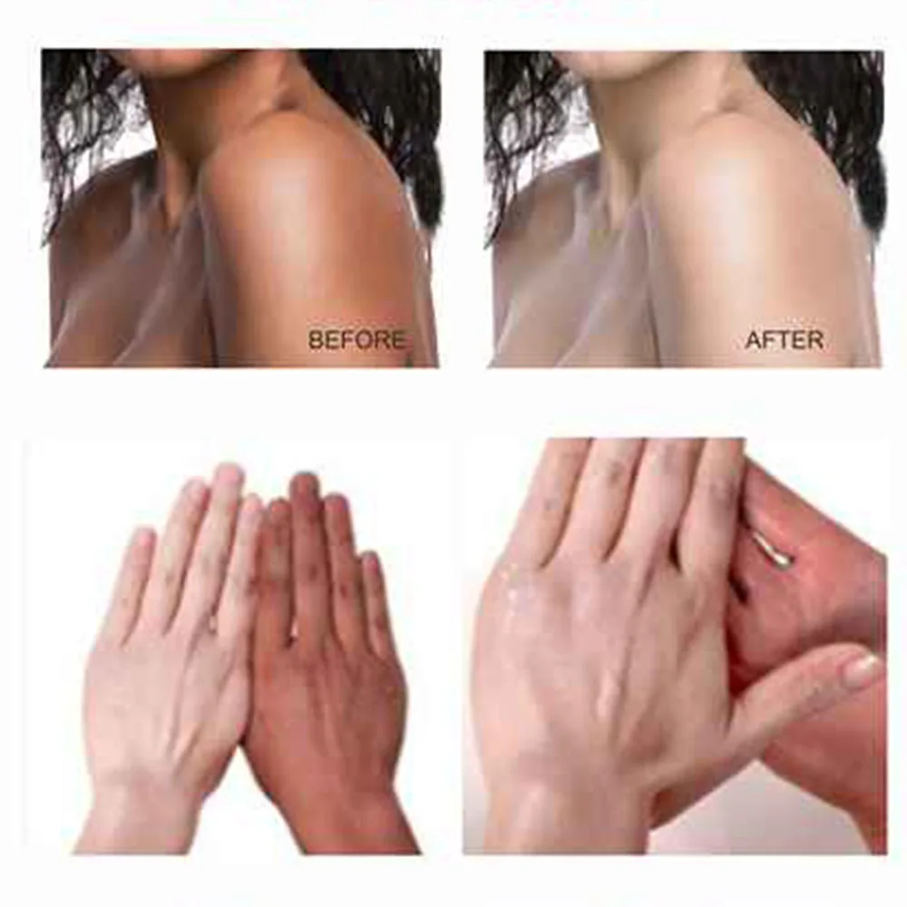 Private Label Natural Organic Skin Moisturize Care Oil Whitening Removing Dark Spots Body Massage Oils