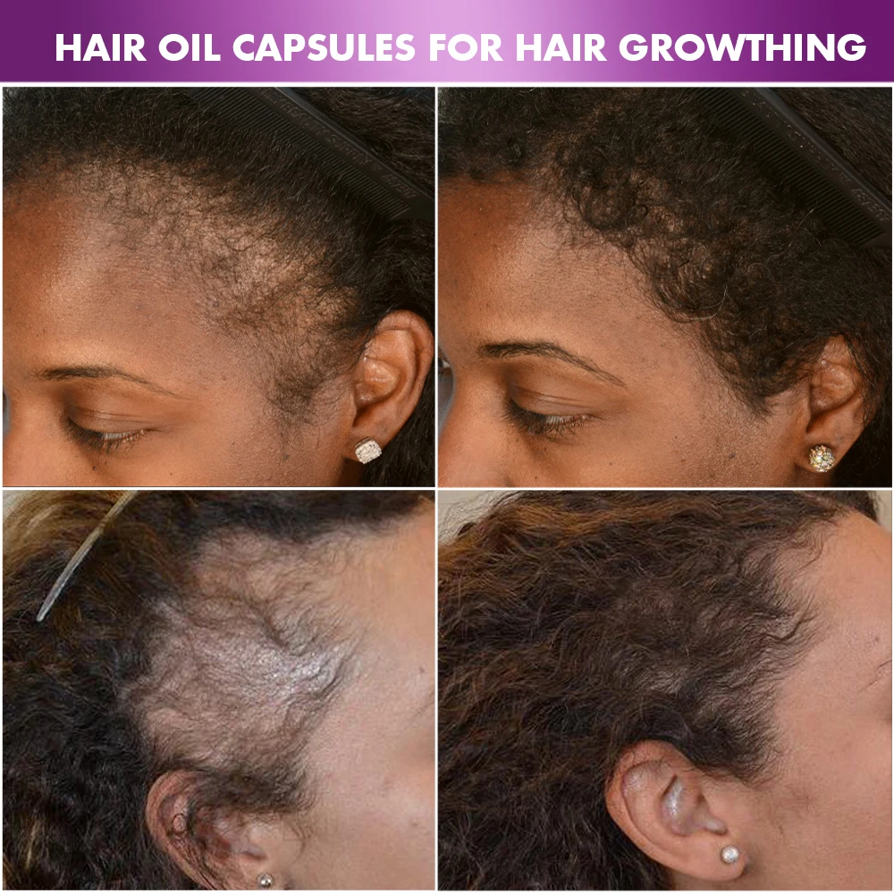 Private Label Natural Professional Salon Hair Care Treatment Growth Oil Smooth Nourishing Hair Serum Vitamin Capsules Wholesale