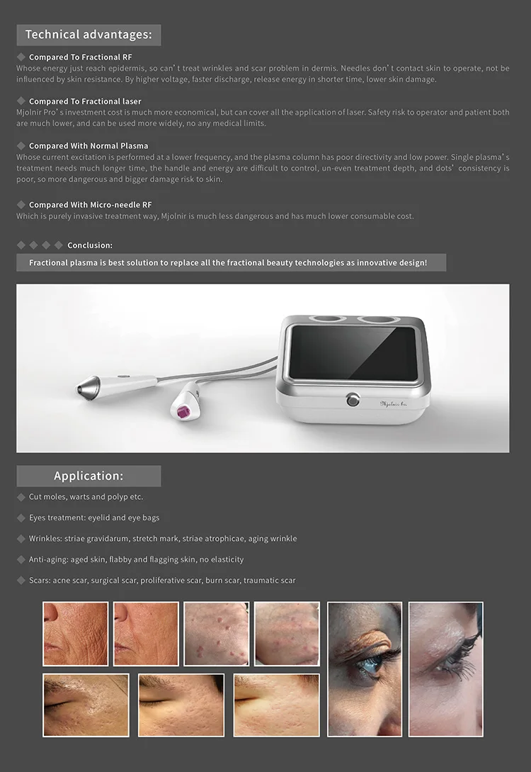 2022 RF Skin Tightening Face Lifting Micro Needle Fractional Rf Machine/micro Needle Rf Machine/leaflife Mjoinir Plasma Pen