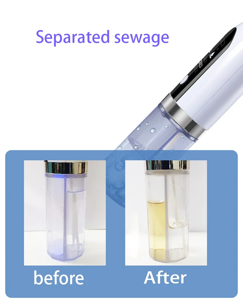 SWIDA Beauty Electric Micro Bubble Water Cycle Vacuum Blackhead Remover Pore Cleaner for Acne Pimple Pore Treatment