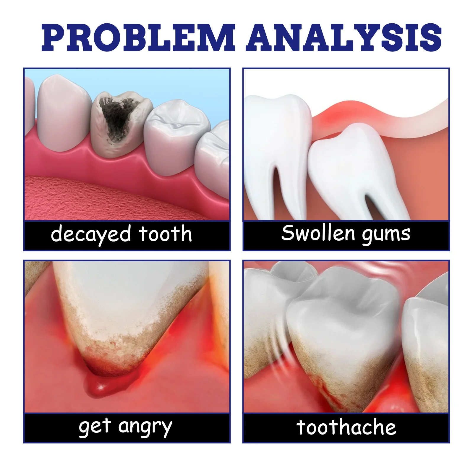 20ml Toothache Relief Spray Swollen Gums Periodontitis Relief Ointment Cavities Teeth Remove Antibacterials Oral Care