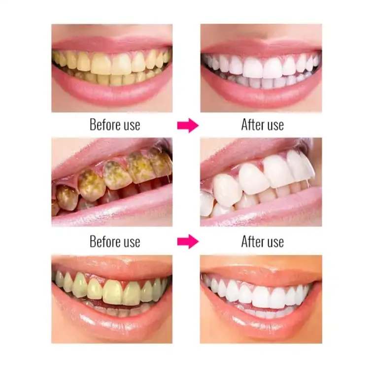 EFERO Teeth Whitening Essence Powder Clean Oral Hygiene Whiten Teeth Remove Plaque Stains Fresh Breath Oral Hygiene Dental Tools