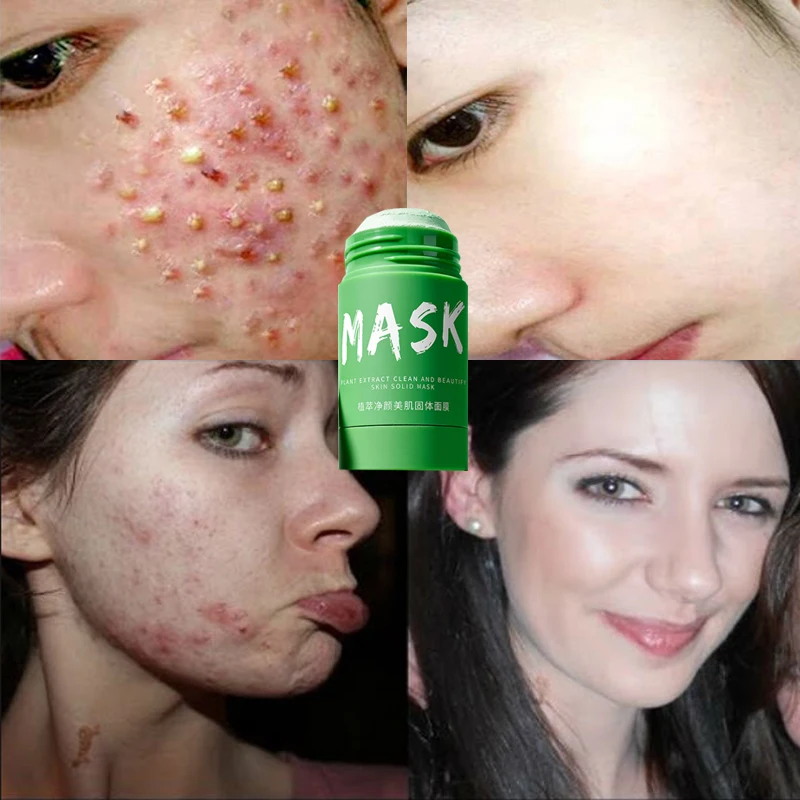Green Tea Solid Mask Deep Cleansing Mask Moisturizing Mud Mask Acne Moisturizing Moisturizing Oil Control