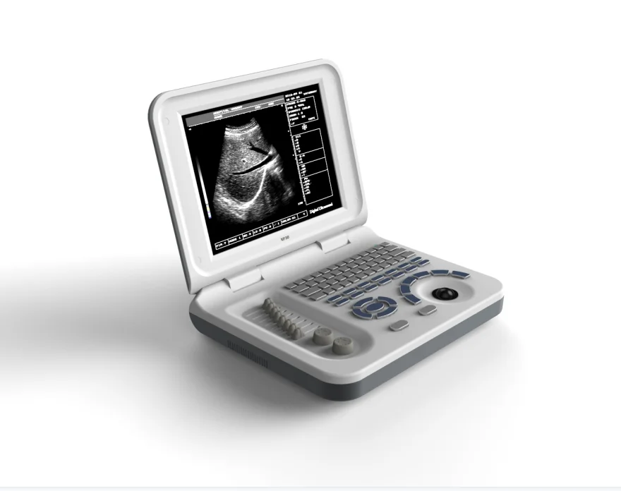 Недорогой Китайский ультразвуковой сканер doppler 10-дюймовый ультразвуковой аппарат кардиограф S30 LED lumify ультразвуковой сканер