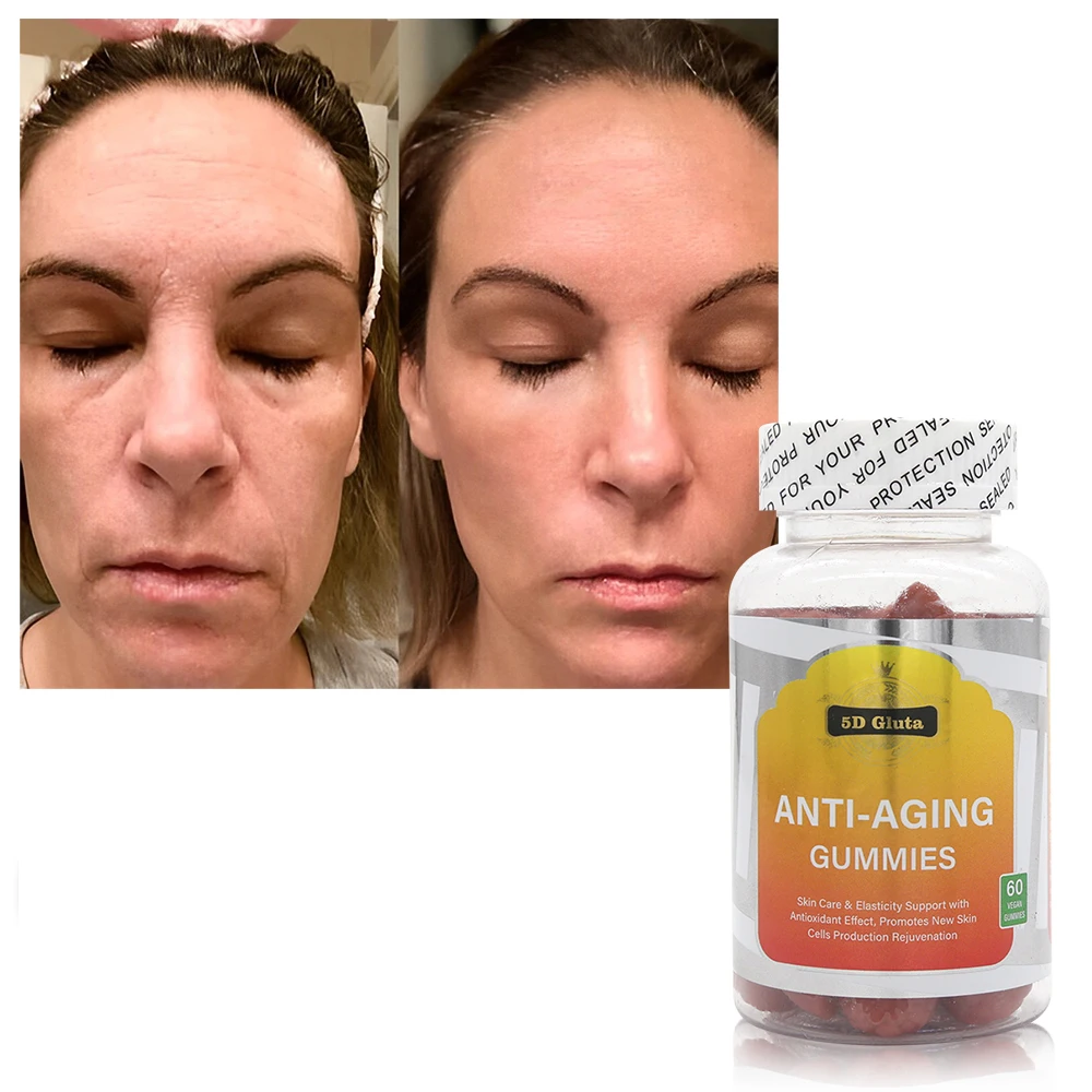 Collagen Gummies Candy Hair Skin And Nails Glutathiones Health Care Product Supplements Vitamins Collagen Gummies For Skin