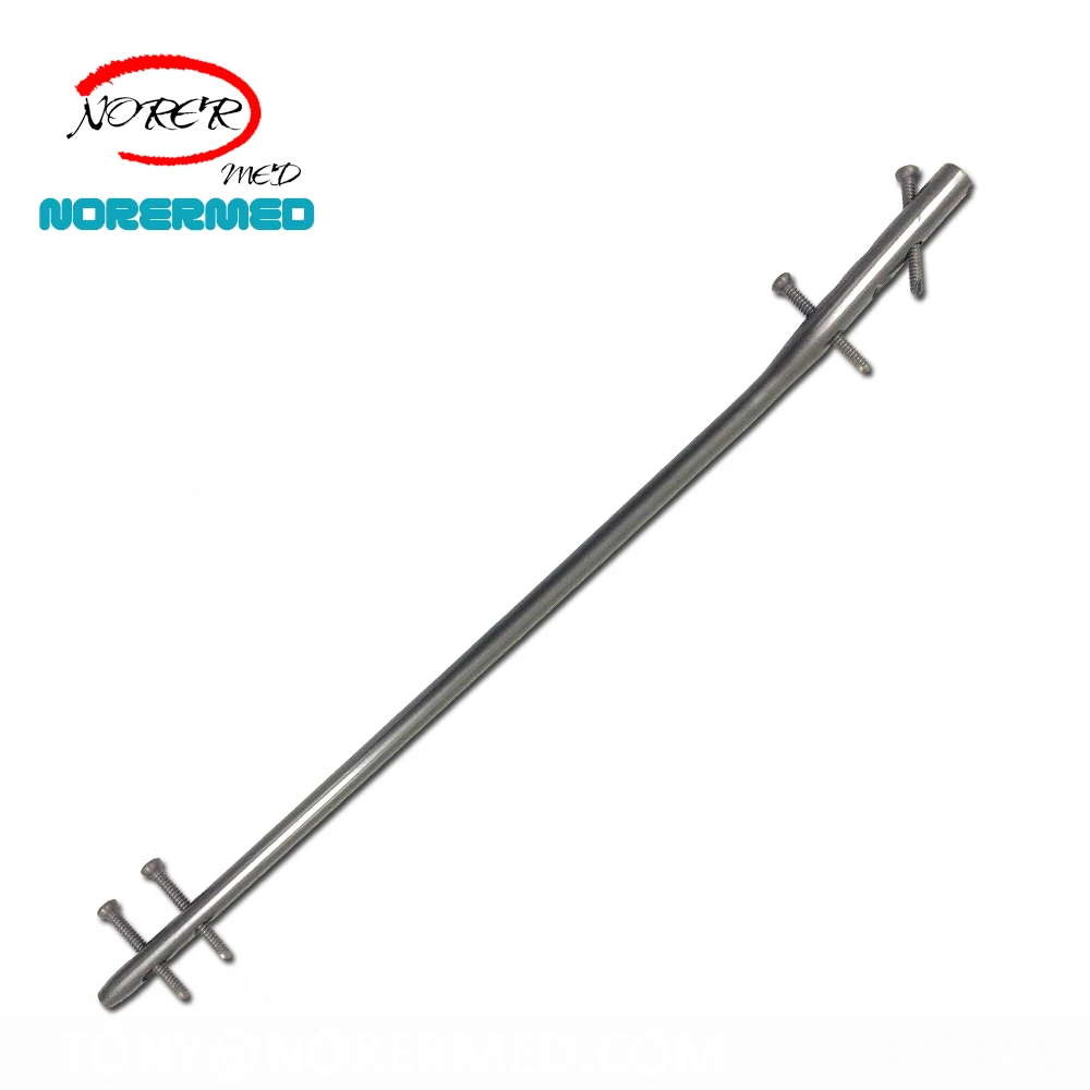 Chinese   Medical Orthopedic  Intramedullary Expert Femur  Nailing Interlocking Nail System for Femoral neck fixat