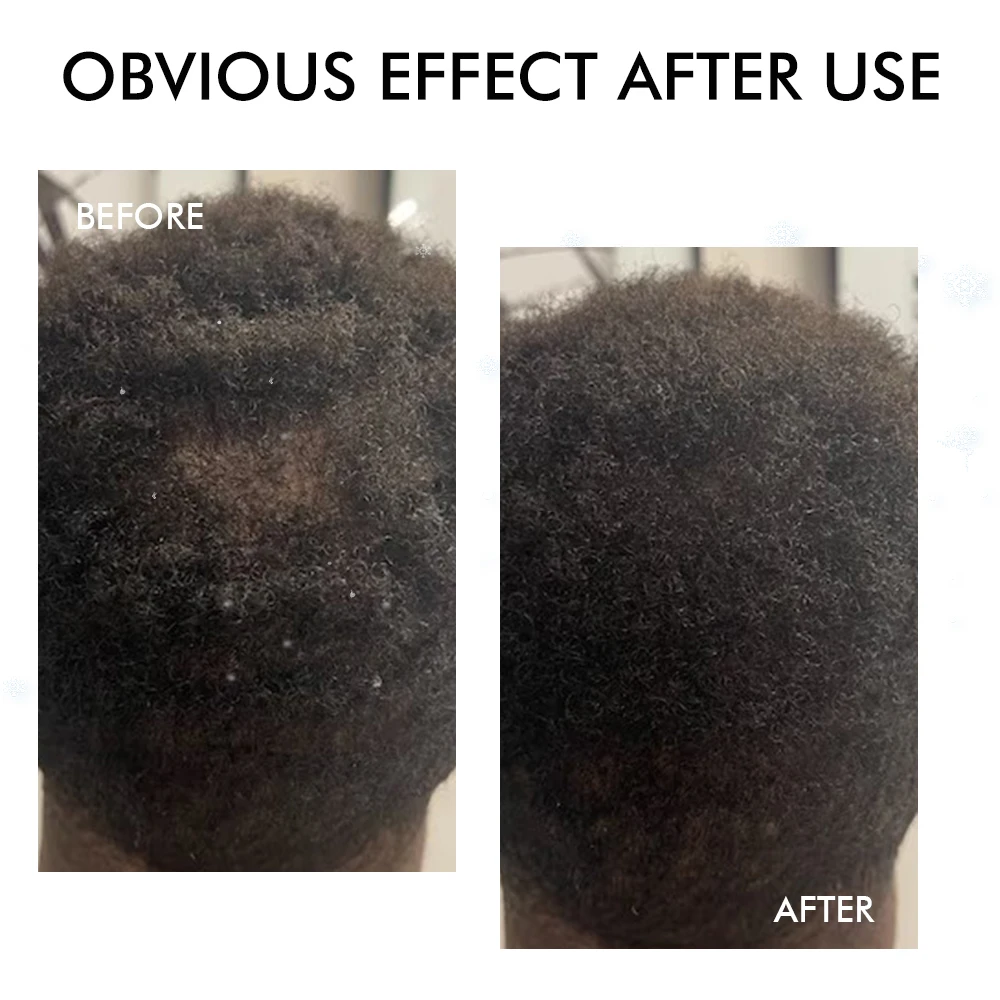 Private Label Men And Women Prevent Hair Loss Regrowth Scalp Oil Stronger Thickening Batana Oil Hair Butter For Growth