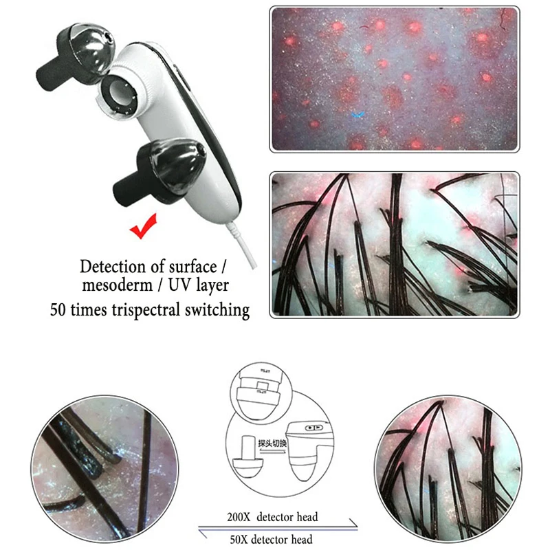 MeiBoYi USB Phone/Ipad/Computer Connection Scalp Skin Hair Follicle Detector High Definition Probe for Hair Care Center