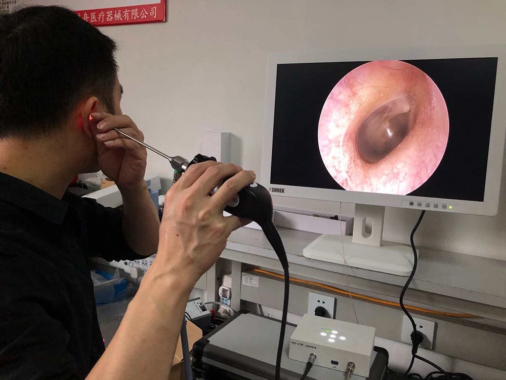 portable sy hd 7020 endoscopic camera for medical surgery system