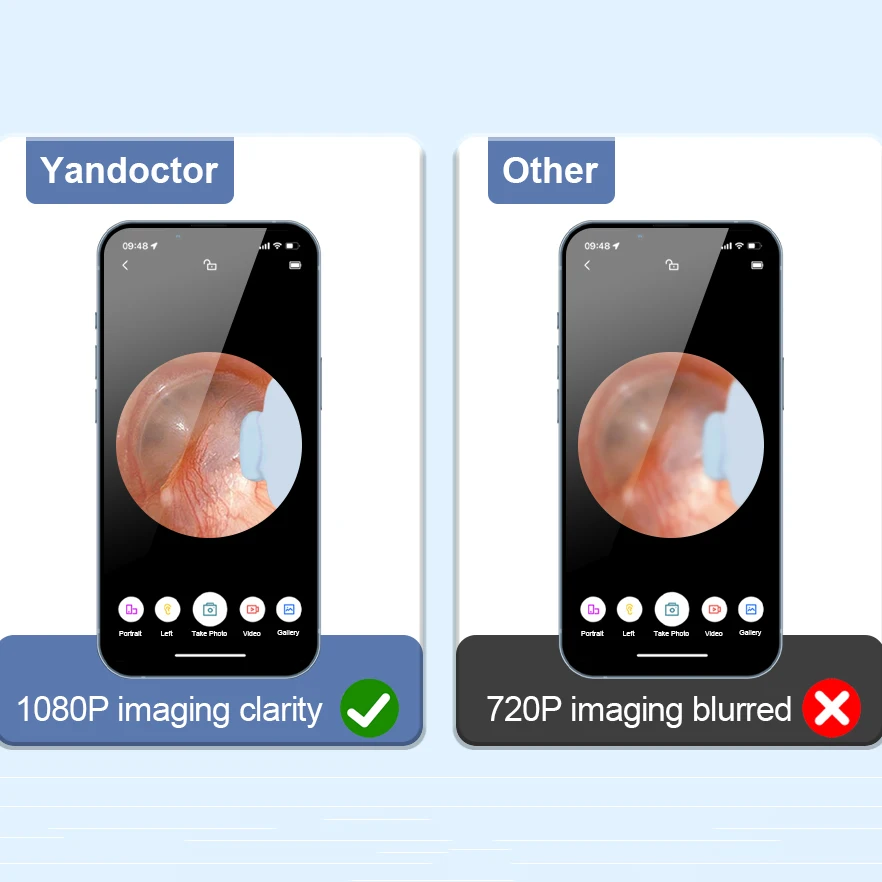 Ear wax cleaning New Arrival Led Smart  Ear wax remove Electric Visual Wifi Wireless Digital Otoscope Camera Mini Hd Video