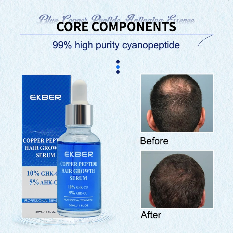 Customize Logo Organic Prevent Hair Loss 5% Ahk-Cu Hair Growth Serum Copper Peptide Biotin Hair Growth Serum