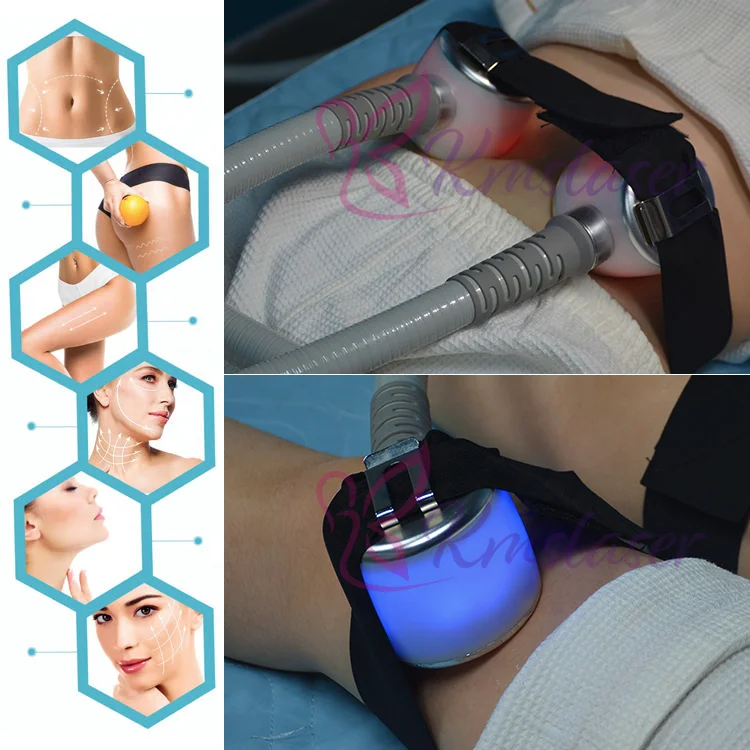 Reach 4cm under the skin slimming Cryoskin cryoslim cold machine cryo cool cryotherapy full body crioterapia cryolipolyse 4.0
