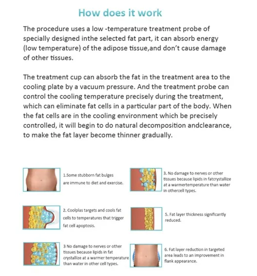 20% off sincoheren 2021 the most advanced technology of fat freezing machine crolipolysis three years warranty
