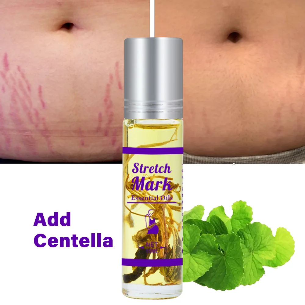 Aromlife Strong Effective Stretch Mark Removal Oil Scar Remover Body Pregnancy Skin Repair Tightening Stretch Marks Oil