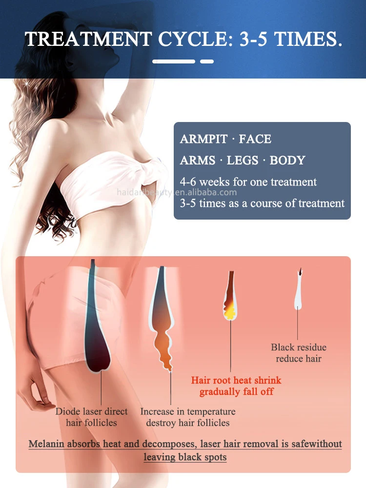 50% OFF! Titanium Laser 808 Diode Laser Hair Removal Machine /755 808 1064 3 wavelenth laser machine hair removal