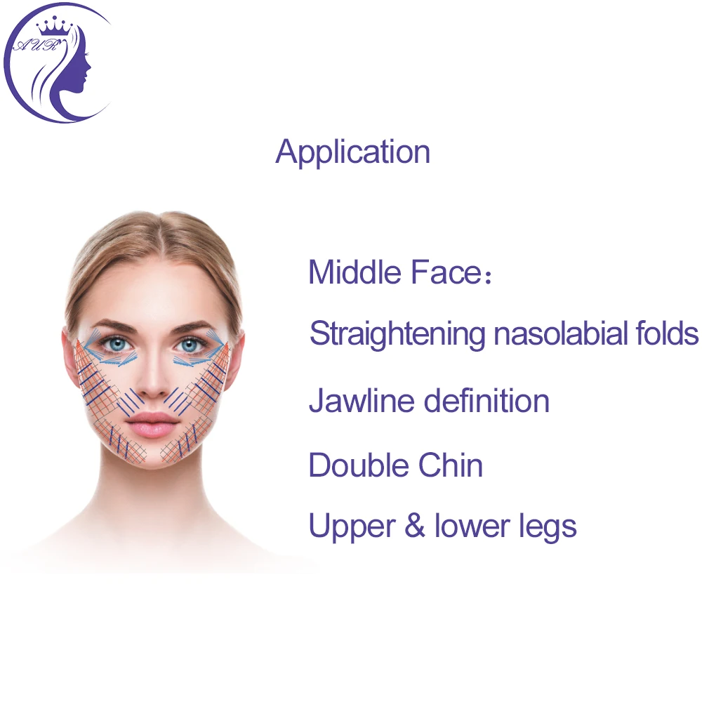 Free shipping cog 6d 19g 100mm sharp needle PCL thread to facial rejuvenation