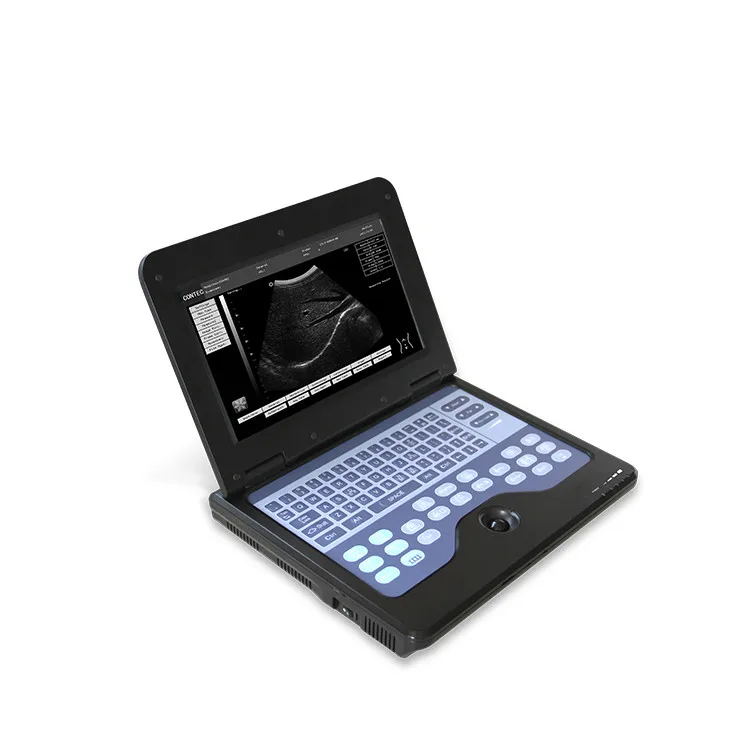 Hongan Medical Ultrasound Machine HospitalUltrasound Instruments Portable B Ultrasound Scanner Equipment Ultrasound Machine