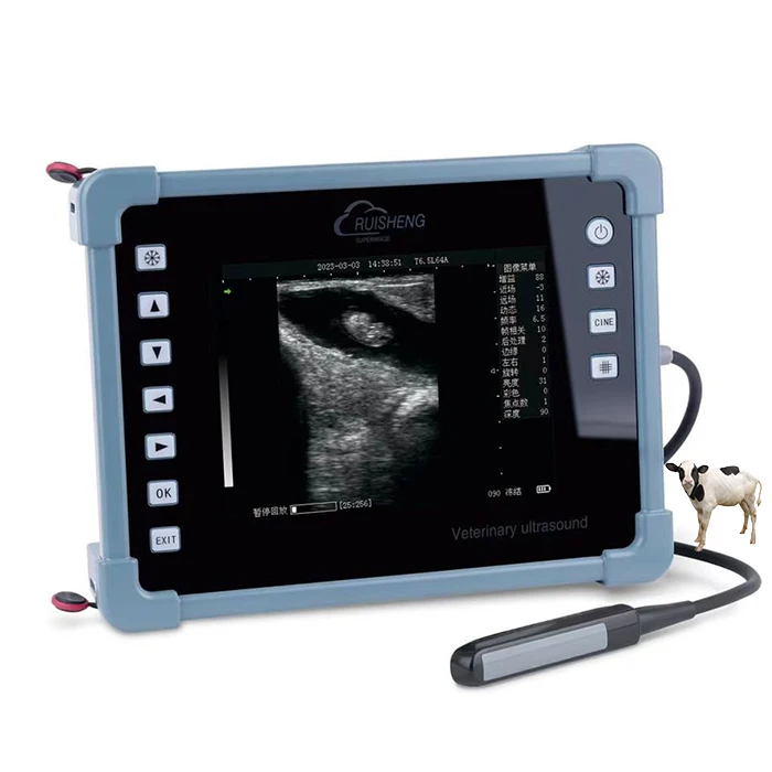 Ультразвуковой цифровой ультразвуковой сканер