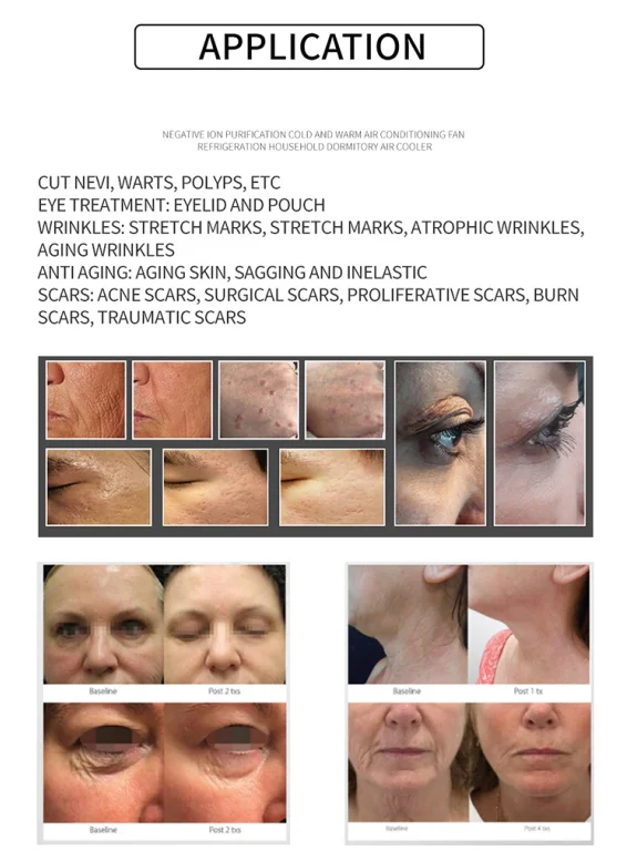 3 In 1 Cold Plasma Device Fibroblast Plasma Pen Machine Cold Plasma Machine Beauty