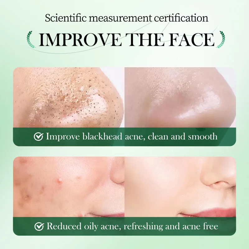 Private Label Mugwort Solid Facial Mask Stick Wholesale Deep Cleaning Oil Control Anti Pores Acne Clay Face Mask